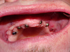 X06906_7