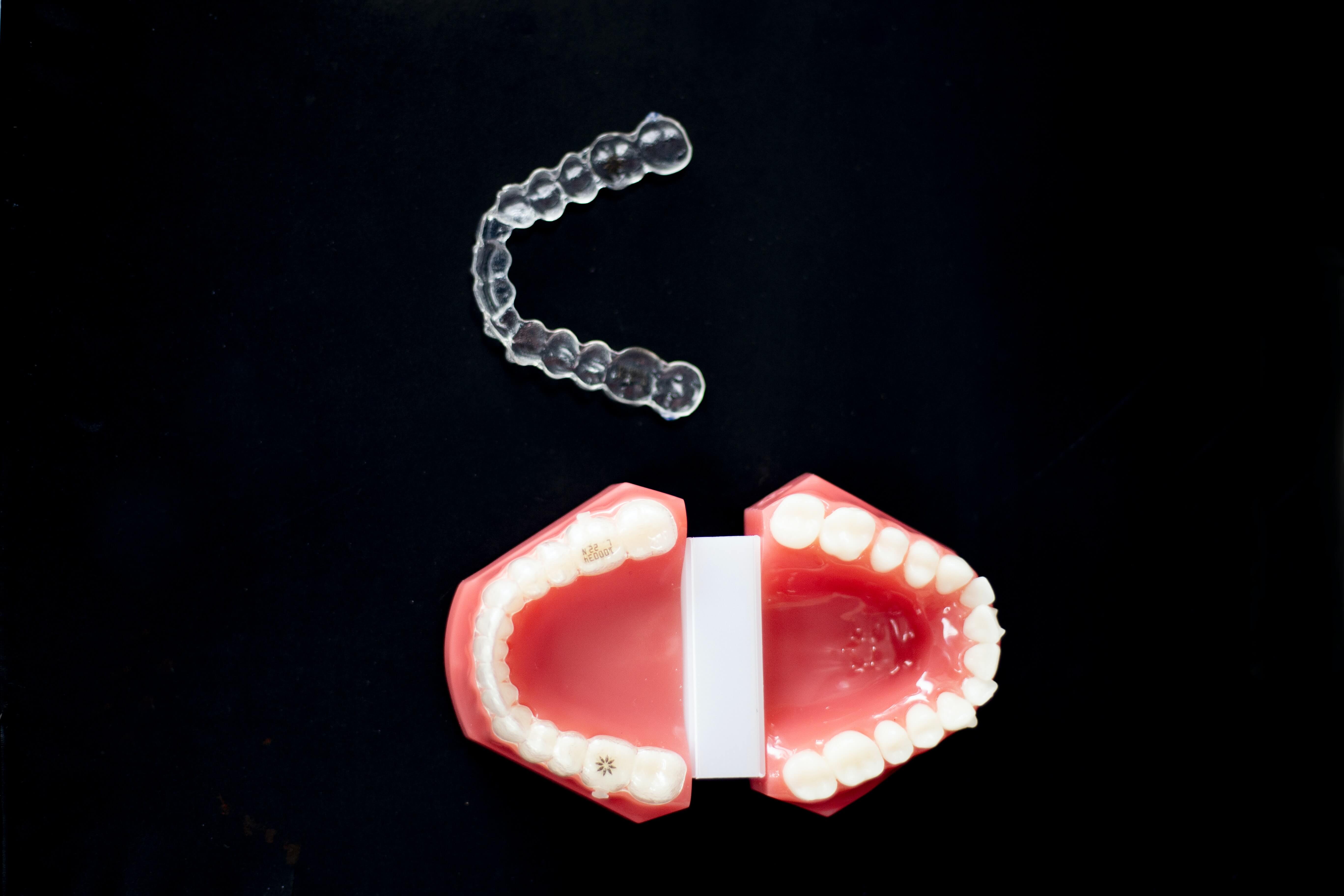 Mail Order Braces