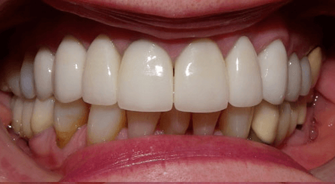Close-up of lips and teeth