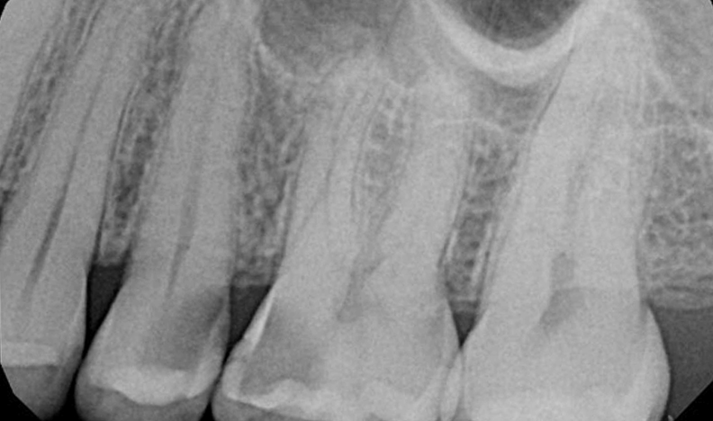 Smile showing upper and lower teeth